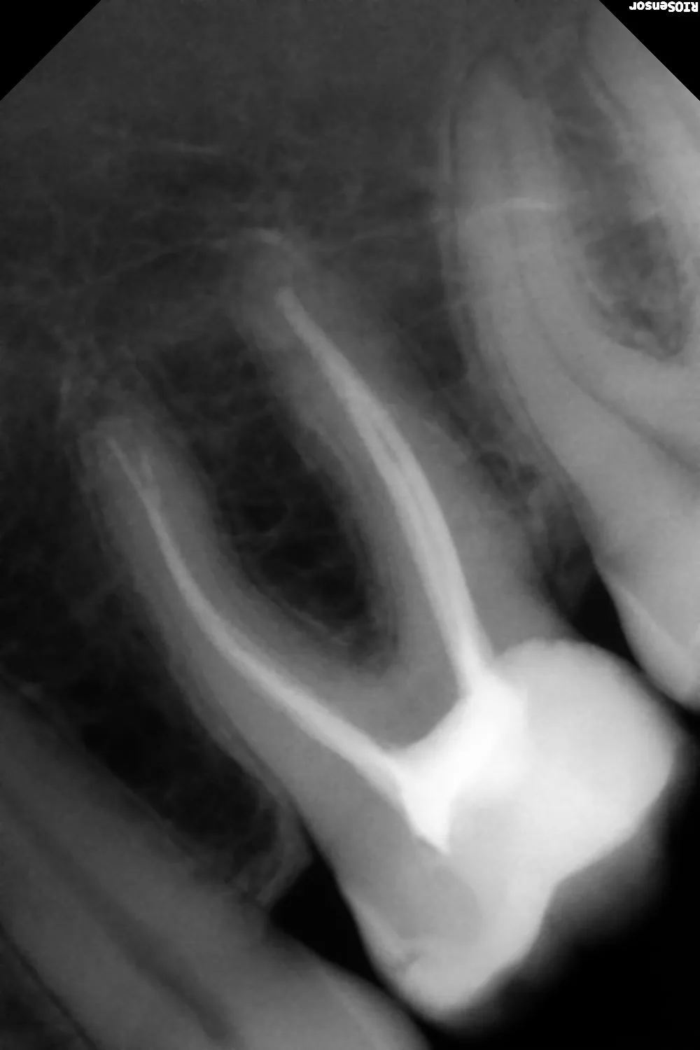 Радиовизиограф RIOSensor RIS500
