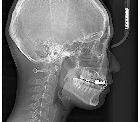 Томограф RAYSCAN Symphony 20х20