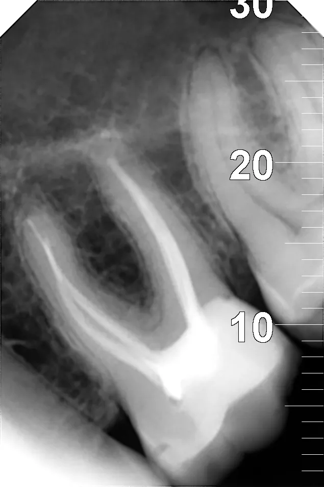Радиовизиограф Zen-X