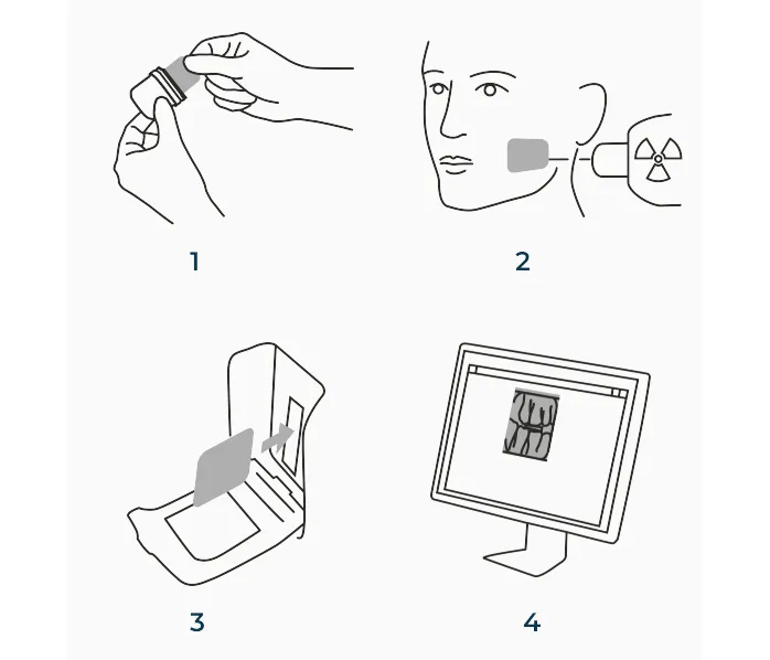 Сканер фосфорных пластин Dexis (KaVo) Scan eXam One