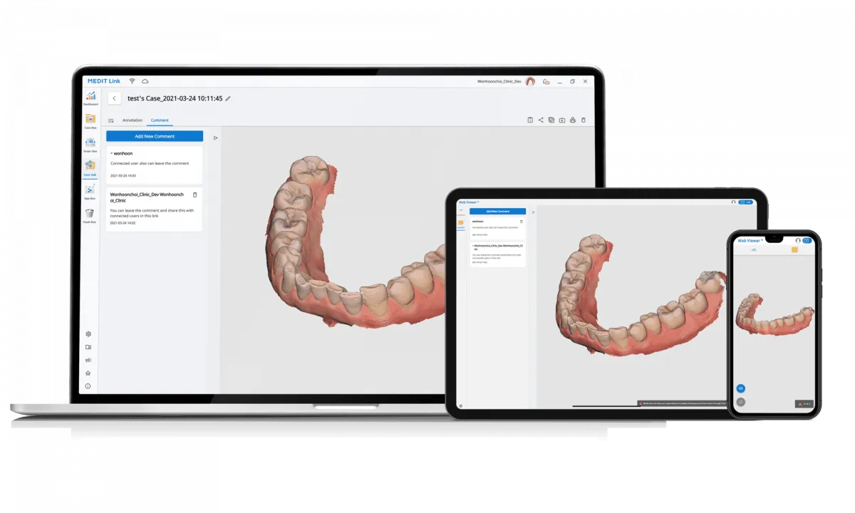 Интраоральный высокоскоростной сканер Medit i700