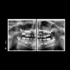 АйТиСтом | Ортопантомограф PAX-I, изображение 3
