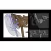АйТиСтом | Hyperion X9 Pro 11x13 Ceph Titanium - дентальный цифровой 3D-томограф с цефалостатом, 3 в 1, FOV 11x13, изображение 6