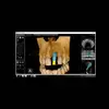 АйТиСтом | CS 8100 3D - дентальный трехмерный томограф, FOV 8х9 см, изображение 7