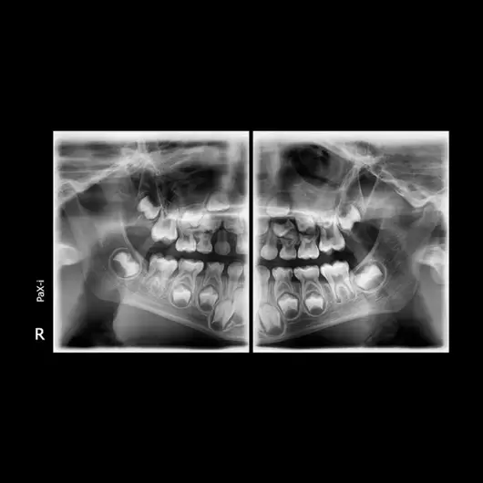 АйТиСтом | Ортопантомограф PAX-i SC с цефалостатом, изображение 6