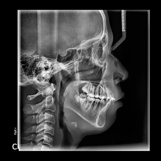 АйТиСтом | Ортопантомограф PAX-I, изображение 2