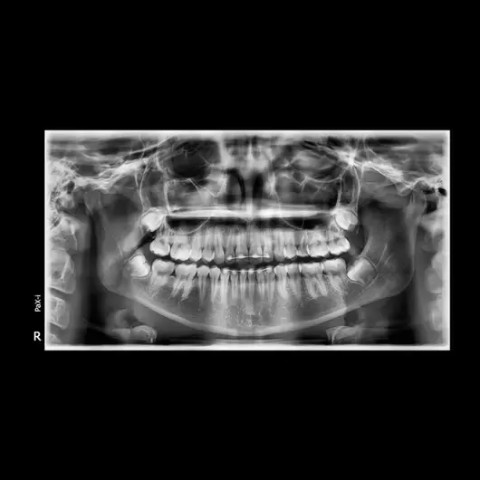 АйТиСтом | Ортопантомограф PAX-I, изображение 4