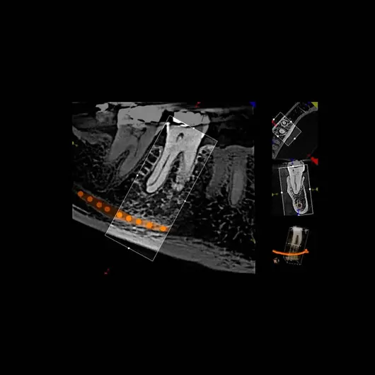 АйТиСтом | CS 8100 3D - дентальный трехмерный томограф, FOV 8х9 см, изображение 8