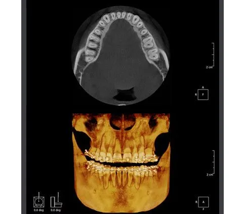 Томограф RAYSCAN Symphony 20х20