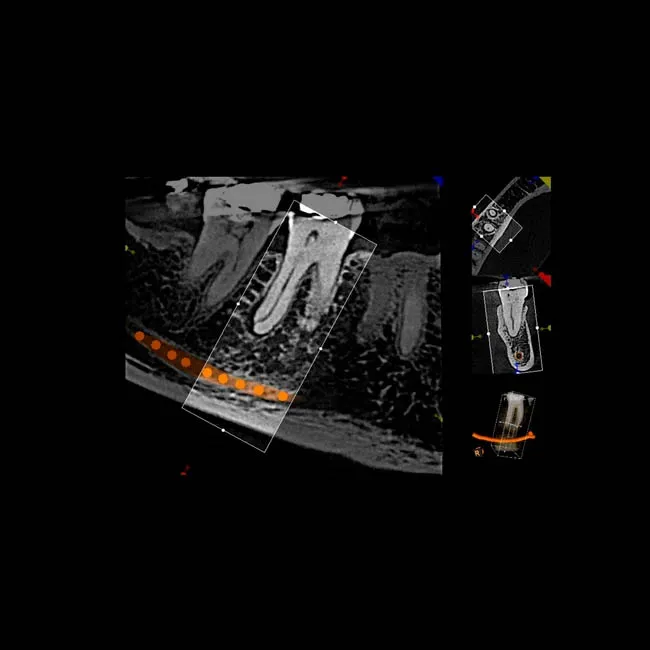 CS 8100 3D - дентальный трехмерный томограф, FOV 8х9 см