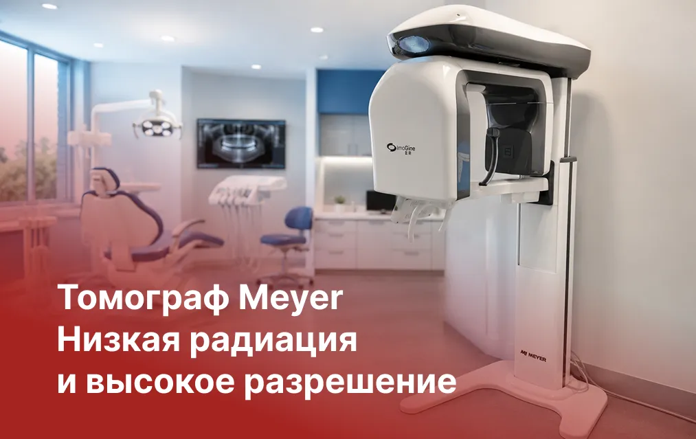 Низкая радиация и высокое разрешение: почему клиники выбирают томографы Meyer