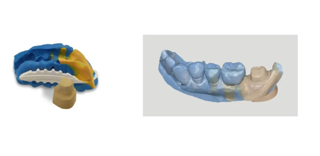 Cтоматологический 3D-сканер Medit Identica Т510