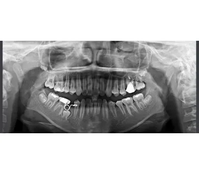 Томограф RAYSCAN Symphony 20х20