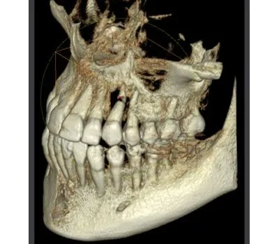 Томограф RAYSCAN Symphony 20х20