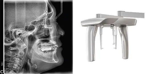 Ортопантомограф PAX-i SC с цефалостатом