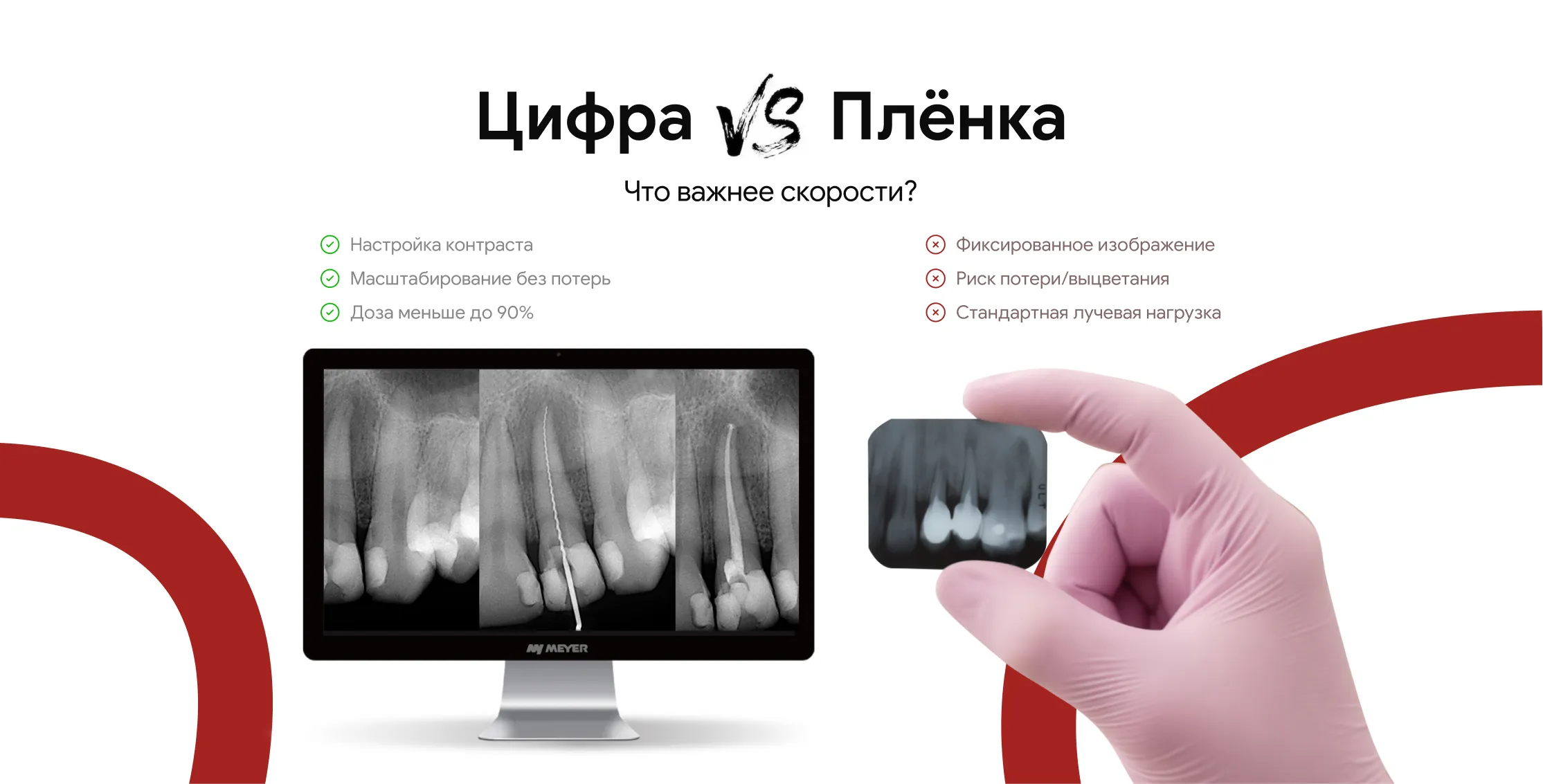 Цифровой визиограф vs плёнка