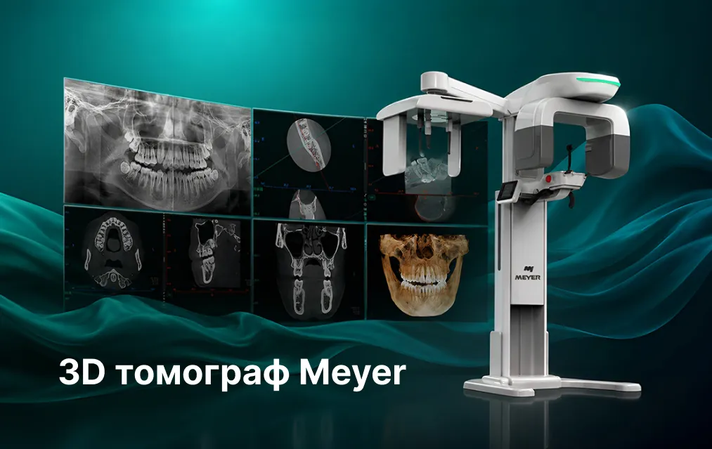 3D томограф Meyer