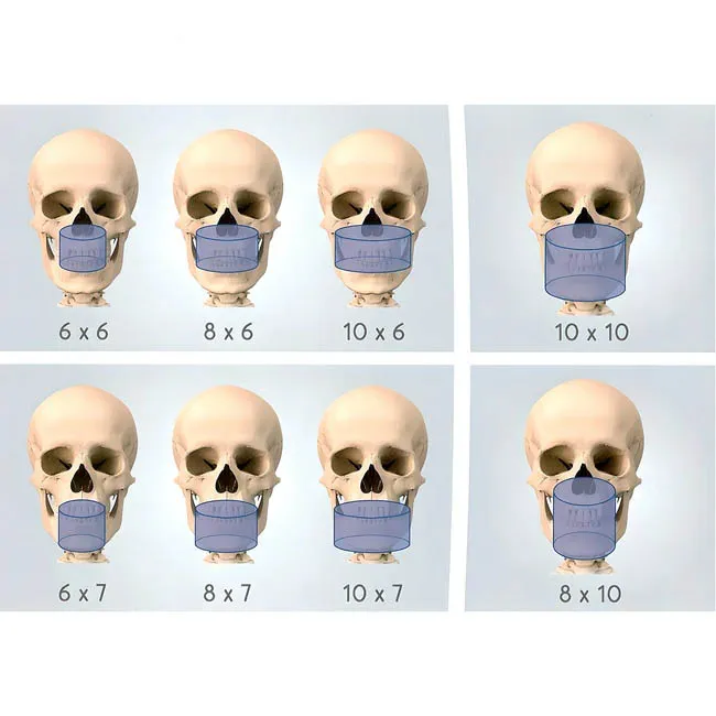 X-Radius Compact 2D - цифровой панорамный рентген-аппарат