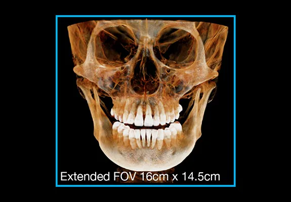 fov_extended_img.jpg fov_extended_img.jpg