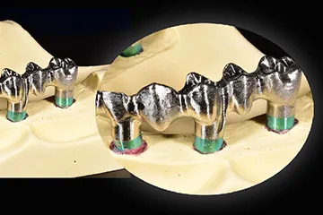 shining-3d-autoscan-ds-mix-4-1.png shining-3d-autoscan-ds-mix-4-1.png