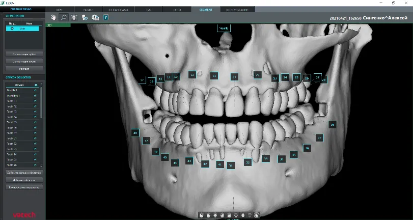 vatech90.png vatech90.png