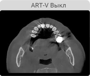 vatech888.png vatech888.png