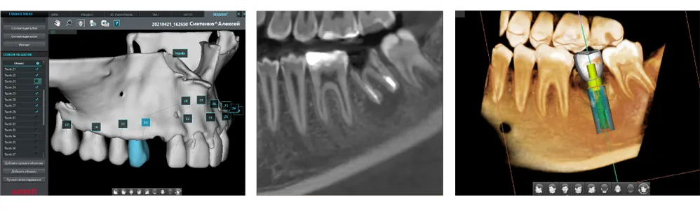 рен.png рен.png