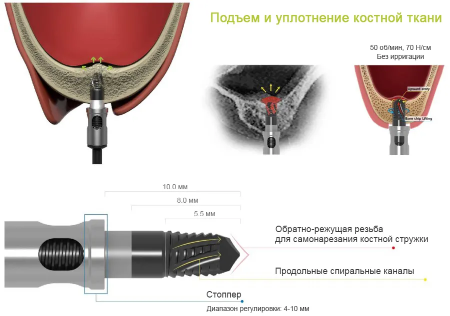 tewjbmudvq5all1xsedi9ex08ljryzn4.jpg tewjbmudvq5all1xsedi9ex08ljryzn4.jpg