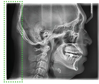 vatech-smart-plus-full-lateral.jpg vatech-smart-plus-full-lateral.jpg