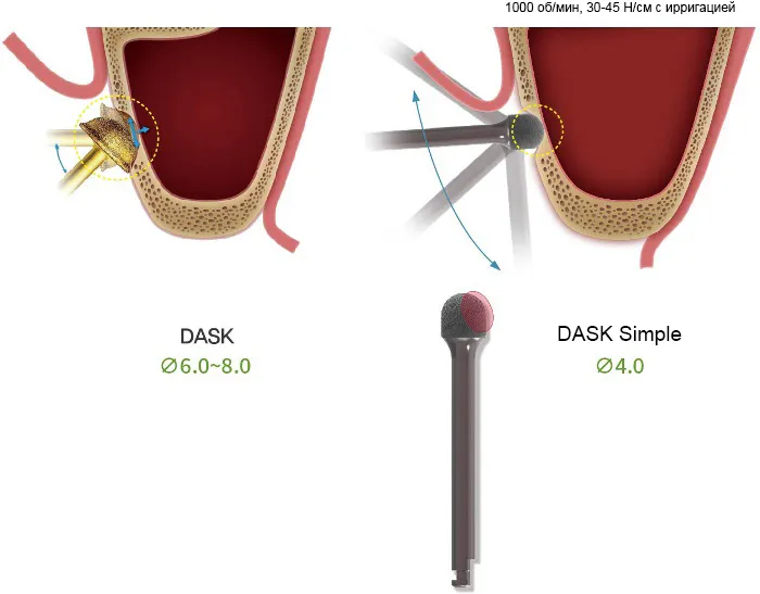 3963e0opkbd0g0cjdfqa30k7gry8qslz.jpg 3963e0opkbd0g0cjdfqa30k7gry8qslz.jpg