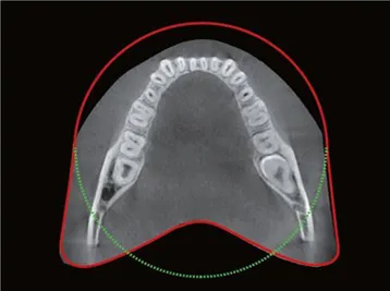 vatech-smart-plus-fov.jpg vatech-smart-plus-fov.jpg