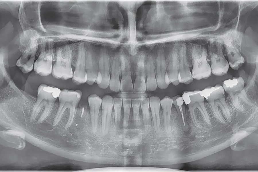 vatech-a9-01.jpg vatech-a9-01.jpg