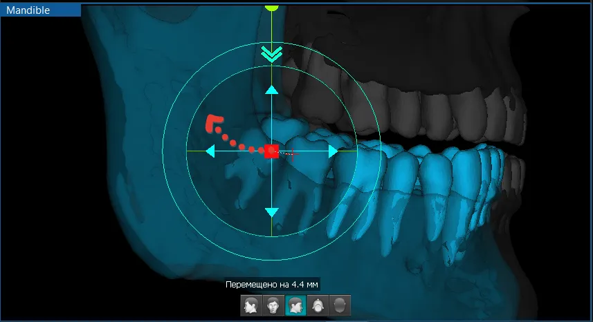 vatech30.png vatech30.png