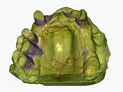 up3d-up1000-scan-example.jpg up3d-up1000-scan-example.jpg