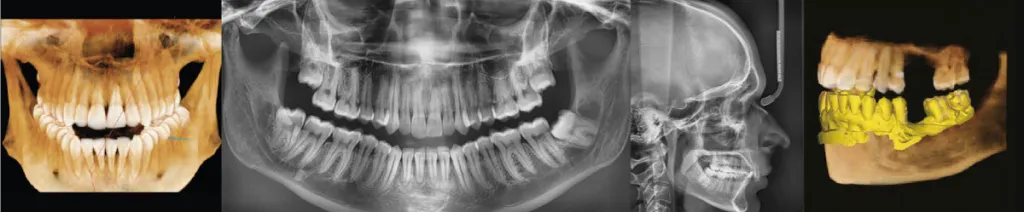 vatech111.jpg vatech111.jpg