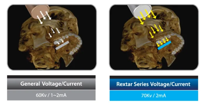 rextar-1.png rextar-1.png