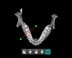 vatech50.png vatech50.png