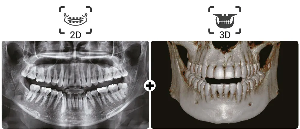 vatech11.jpg vatech11.jpg
