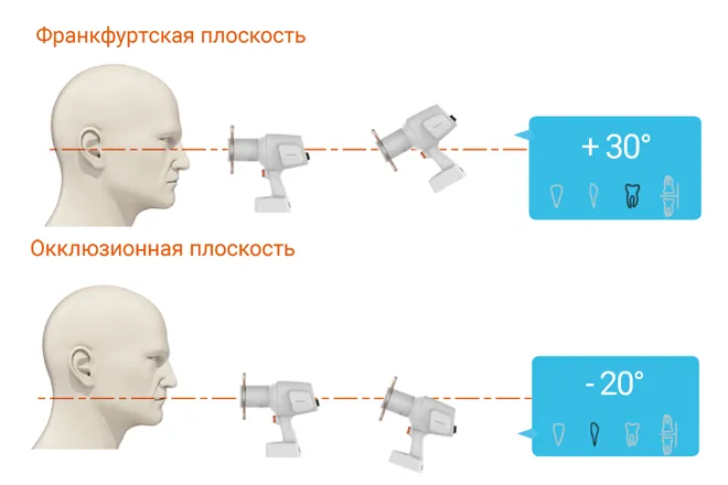 vatech-ezray-air-portable-1.png vatech-ezray-air-portable-1.png