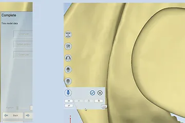 shining-3d-autoscan-ds-mix-3-1.png shining-3d-autoscan-ds-mix-3-1.png