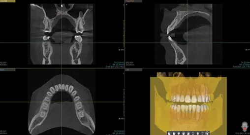 vatech-a9-06.jpg vatech-a9-06.jpg