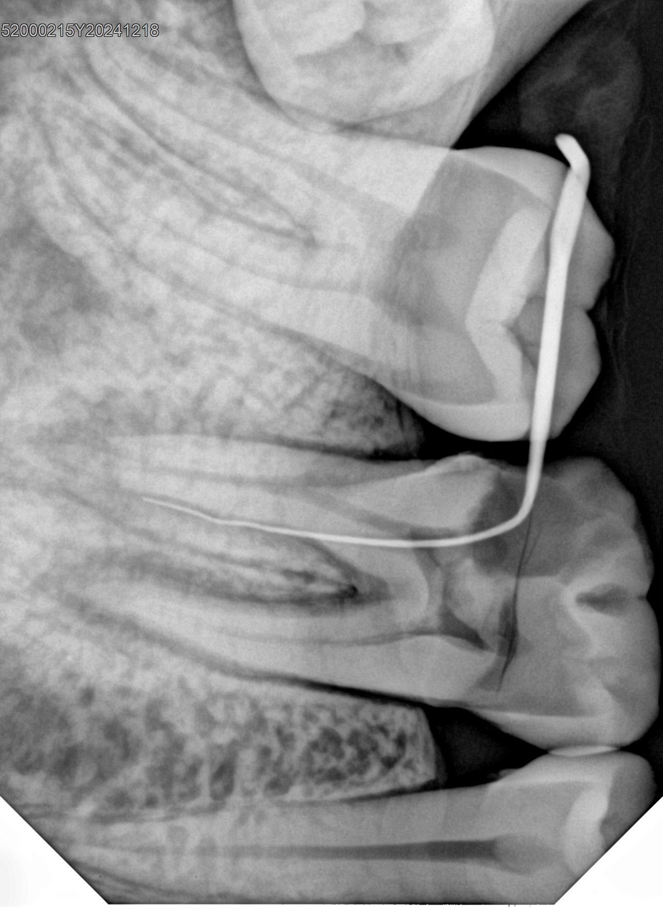 Визиограф интраоральный HDR-380