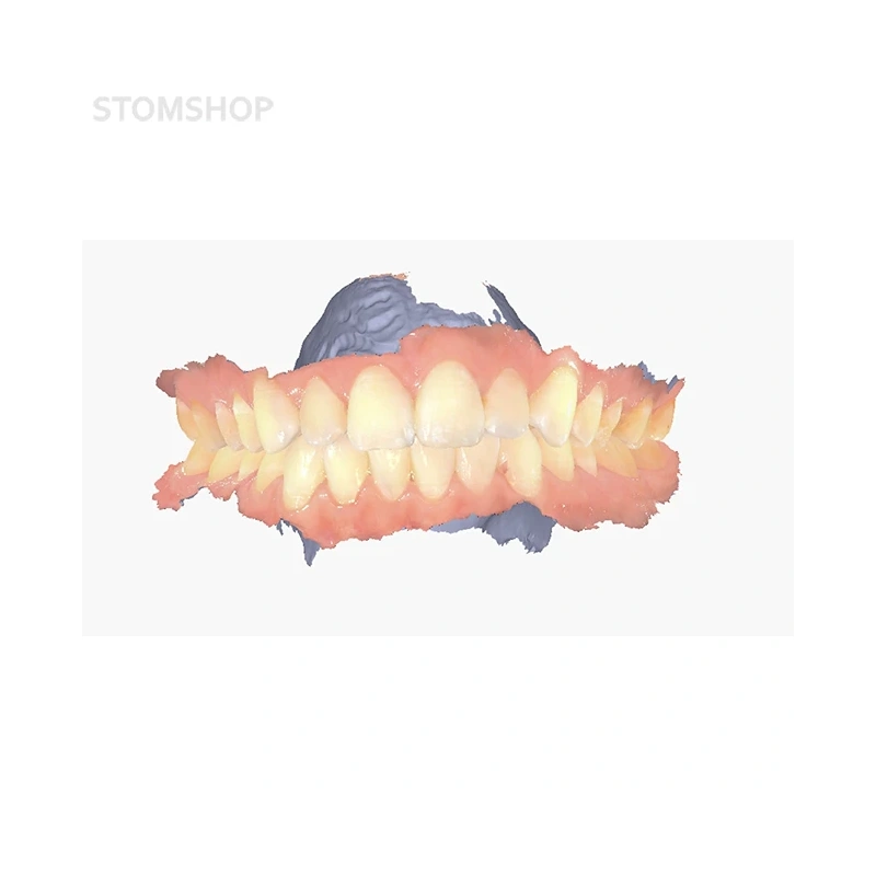 Aoralscan Elite - проводной интраоральный сканер с функцией интраоральной фотограмметрии, в комплекте с набором скан-маркеров | Shining 3D (Китай)
