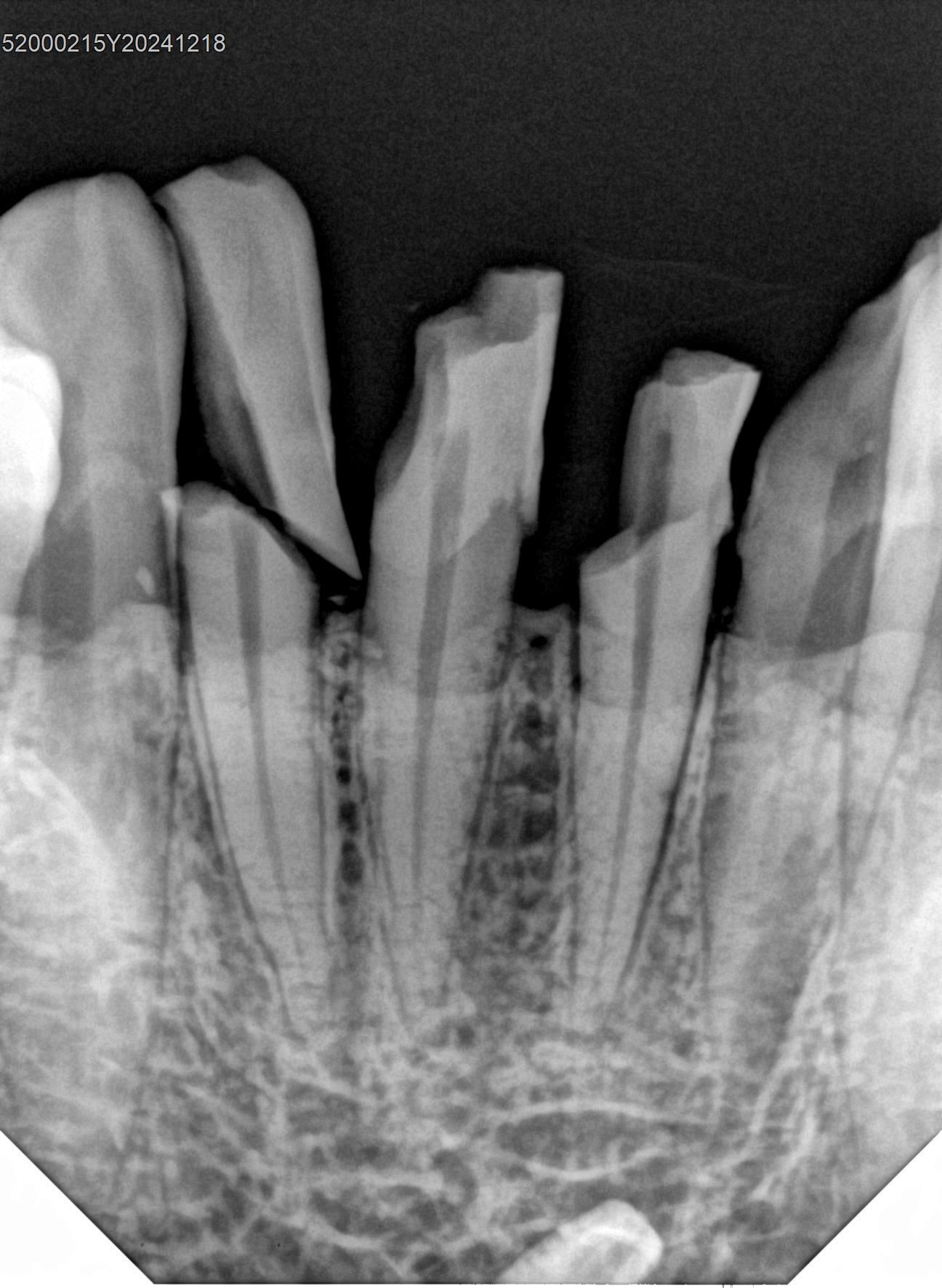 Визиограф интраоральный HDR-380