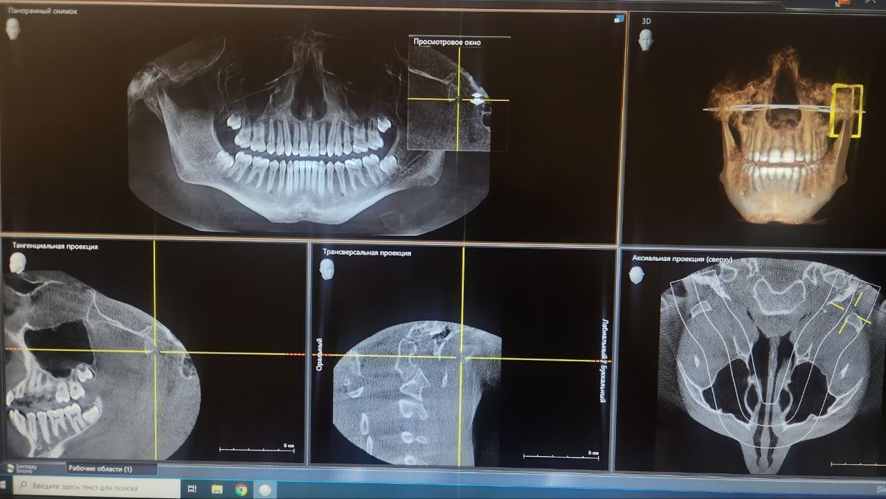 Компьютерный томограф Sirona Galileos (15х15 cm) б/у